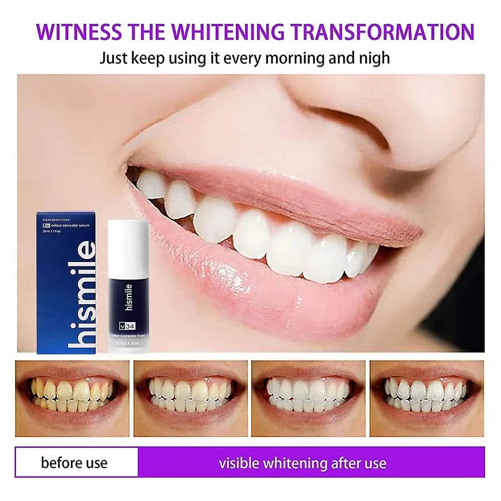 ✨ HiSmile V34 Purple Teeth Whitening Serum – Instant Stain Removal & Brighter Smile 💜😊